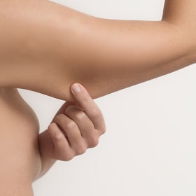 LIFTING BRAQUIAL/ BRAQUEOPLASTIA