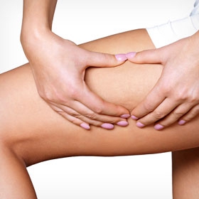 LIFTING DE COXAS / CRUROPLASTIA